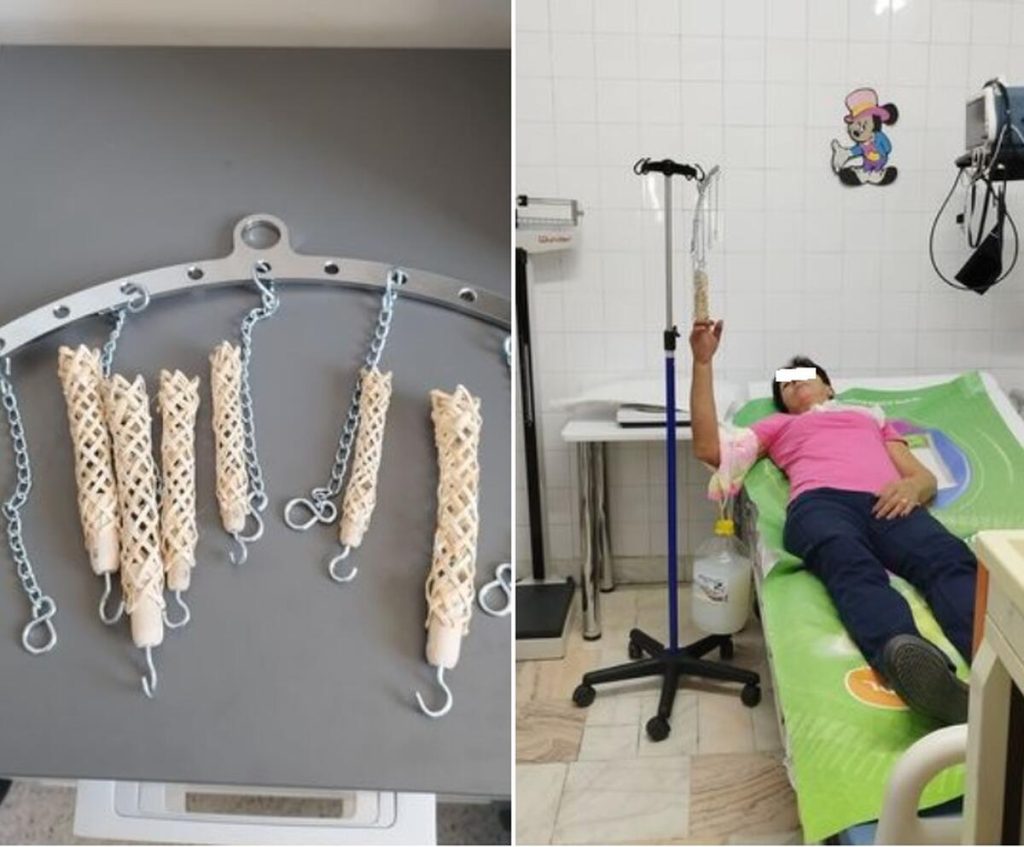 Dispozitiv medical cumpărat de medicii de la spitalul din Târgu Cărbunești din banii lor